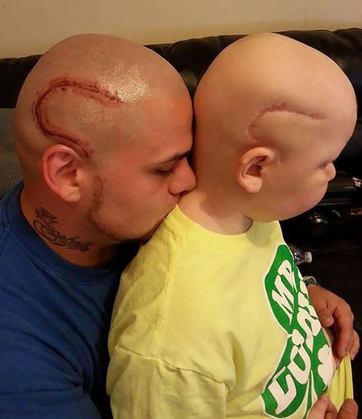 Dad Gets Tattooed So His Son With Cancer Won’t Feel Alone.