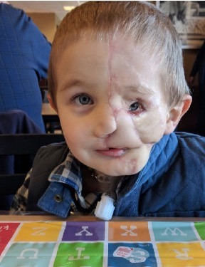 A 5-year-old boy survives a brutal attack by two…